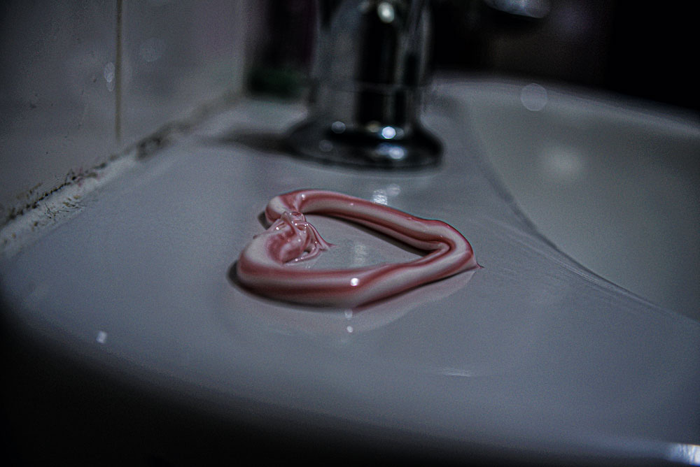 Bloodworms