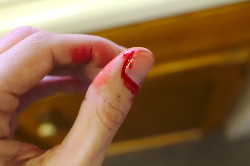 Infection Prevention Infection Prevention