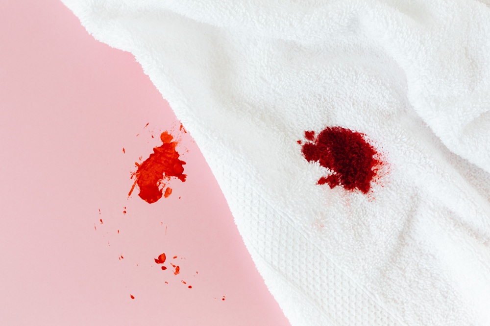 How To remove blood from fabric?