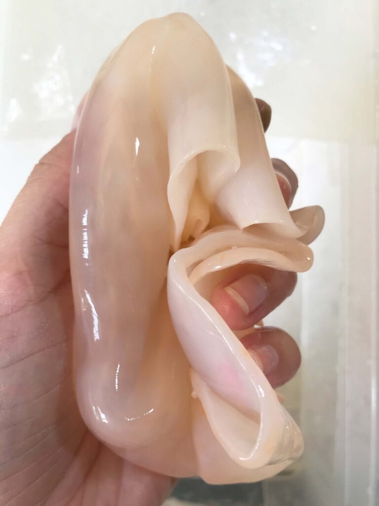 Microbial Cellulose